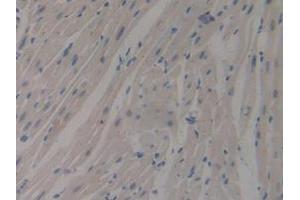 IHC-P analysis of Mouse Heart Tissue, with DAB staining.