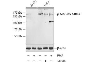 Western blot analysis of extracts of A-431 and HeLa cells, using Phospho-MK5-S1033 antibody (ABIN3019484, ABIN3019485, ABIN3019486 and ABIN6225423) at 1:1000 dilution. (ASK1 anticorps  (pSer1033))