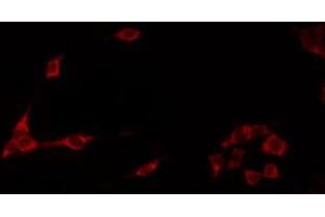 ABIN6272249 staining Hela by IF/ICC. (ARRDC1 anticorps  (C-Term))