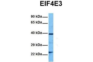 Host:  Rabbit  Target Name:  EIF4E3  Sample Tissue:  Human DLD1  Antibody Dilution:  1. (EIF4E3 anticorps  (Middle Region))