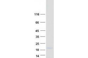 Validation with Western Blot