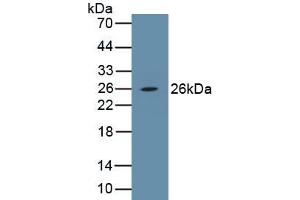 Detection of Recombinant PDGFB, Porcine using Polyclonal Antibody to Platelet Derived Growth Factor Subunit B (PDGFB) (PDGFB anticorps  (AA 84-199))