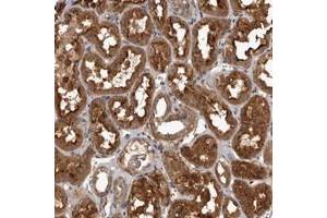Immunohistochemical staining of human kidney with TRMT61B polyclonal antibody  shows strong cytoplasmic positivity in tubular cells.