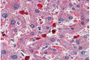 Human Liver: Formalin-Fixed, Paraffin-Embedded (FFPE) (CBS anticorps  (AA 1-101))
