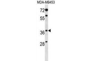 Western Blotting (WB) image for anti-Progestin and AdipoQ Receptor Family Member VIII (PAQR8) antibody (ABIN2998287) (PAQR8 anticorps)
