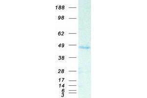 Validation with Western Blot