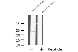 Western blot analysis of INSL6 expression in Human fetal kidney lysate,The lane on the left is treated with the antigen-specific peptide. (INSL6 anticorps  (Internal Region))