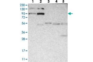 Western blot analysis of Lane 1: RT-4, Lane 2: U-251 MG, Lane 3: Human Plasma, Lane 4: Liver, Lane 5: Tonsil with FER polyclonal antibody  at 1:250-1:500 dilution.