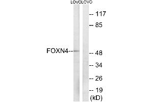 Western blot analysis of extracts from LOVO cells, using FOXN4 antibody.
