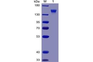 Human CD96 Protein, mFc-His Tag on SDS-PAGE under reducing condition. (CD96 Protein (CD96) (mFc-His Tag))