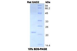 SDS-PAGE analysis of Rat GAD2 Protein. (GAD65 Protéine)