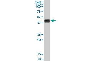 HLA-A MaxPab polyclonal antibody.