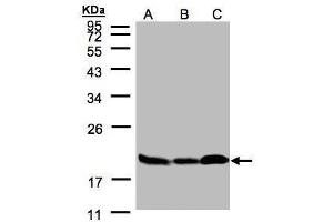 WB Image Sample(30 μg of whole cell lysate) A:293T B:A431, C:H1299 12% SDS PAGE antibody diluted at 1:3000