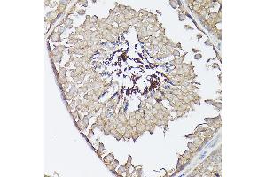Immunohistochemistry of paraffin-embedded mouse testis using CX3CL1 Rabbit pAb (ABIN6129035, ABIN6139265, ABIN6139266 and ABIN6218481) at dilution of 1:150 (40x lens).