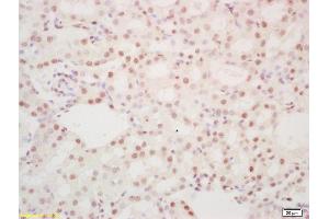Formalin-fixed and paraffin embedded mouse kidney labeled with Rabbit Anti hospho-DDX5 (Tyr593) Polyclonal Antibody, Unconjugated (ABIN1387375) at 1:200 followed by conjugation to the secondary antibody and DAB staining