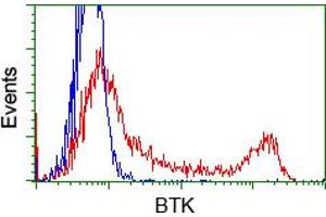 Image no. 1 for anti-Bruton Agammaglobulinemia tyrosine Kinase (BTK) antibody (ABIN1496975) (BTK anticorps)