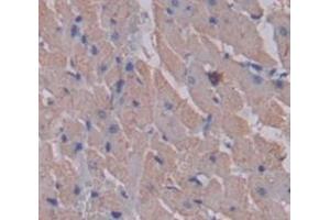 Used in DAB staining on fromalin fixed paraffin- embedded Kidney tissue (MYLK2 anticorps  (AA 327-536))