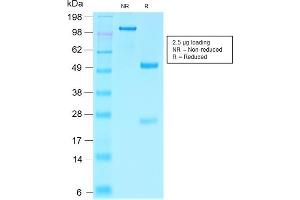 SDS-PAGE Analysis Purified Villin Rabbit Recombinant Monoclonal Antibody (VIL1/2310R).
