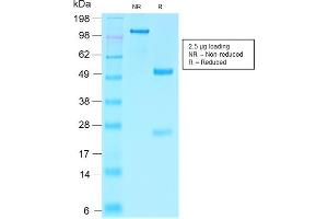 SDS-PAGE Analysis Purified Villin Rabbit Recombinant Monoclonal Antibody (VIL1/2310R). (Recombinant Villin 1 anticorps  (AA 179-311))