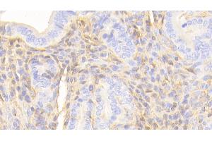 Detection of APOA1 in Mouse Uterus Tissue using Polyclonal Antibody to Apolipoprotein A1 (APOA1)