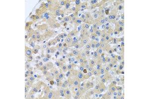 Immunohistochemistry of paraffin-embedded human liver using APOA5 antibody at dilution of 1:100 (40x lens). (APOA5 anticorps)