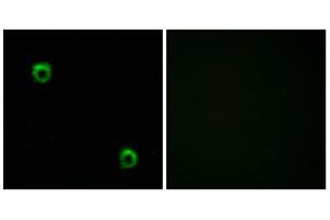 Immunofluorescence analysis of MCF-7 cells, using FZD2 antibody. (FZD2 anticorps  (Internal Region))
