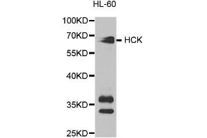 Western blot analysis of extracts of HL-60 cell lines, using HCK antibody. (HCK anticorps)