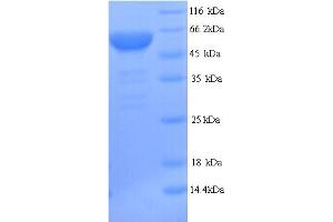 SDS-PAGE (SDS) image for Uromodulin (UMOD) (AA 25-588) protein (His tag) (ABIN5713930)