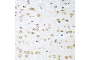 Immunohistochemistry of paraffin-embedded mouse brain using CCND2 antibody at dilution of 1:100 (40x lens). (Cyclin D2 anticorps)