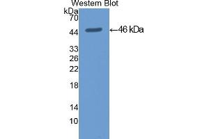Detection of Recombinant KRT19, Mouse using Polyclonal Antibody to Cytokeratin 19 (CK19) (Cytokeratin 19 anticorps  (AA 1-403))