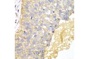 Immunohistochemistry (IHC) image for anti-Epithelial Cell Adhesion Molecule (EPCAM) (AA 40-260) antibody (ABIN6215463) (EpCAM anticorps  (AA 40-260))