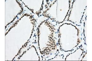 Immunohistochemical staining of paraffin-embedded Human colon tissue using anti-EIF2S1 mouse monoclonal antibody. (EIF2S1 anticorps)