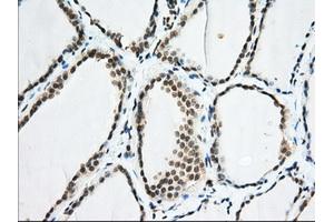 Immunohistochemical staining of paraffin-embedded Human colon tissue using anti-EIF2S1 mouse monoclonal antibody. (EIF2S1 anticorps)