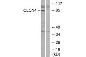 Western blot analysis of extracts from MCF-7 cells, using CLCN4 Antibody. (CLCN4 anticorps  (AA 221-270))