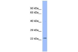 WB Suggested Anti-AK3L1 Antibody Titration:  0. (AK4 anticorps  (N-Term))