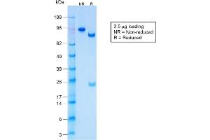 SDS-PAGE Analysis Purified CK LMW Rabbit Recombinant Monoclonal Antibody (KRTL/1577R). (Recombinant Keratin 77 anticorps)