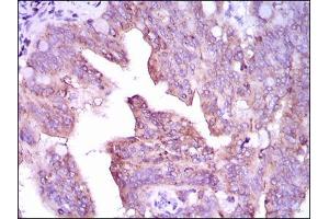 Western blot analysis using CAMK4 antibody against Jurkat (1), SK-N-SH (2), Raji (3), and HeLa (4) cell lysate.
