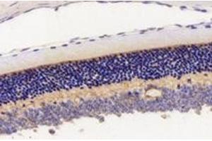 Immunohistochemistry analysis of paraffin-embedded mouse eyeball using,KCNV2 (ABIN7075150) at dilution of 1: 2800