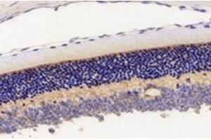 Immunohistochemistry analysis of paraffin-embedded mouse eyeball using,KCNV2 (ABIN7075150) at dilution of 1: 2800 (KCNV2 anticorps)