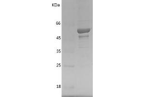 Western Blotting (WB) image for Toll Interacting Protein (TOLLIP) (AA 2-274) protein (GST tag) (ABIN7125410)