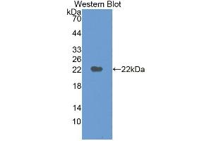 Western blot analysis of the recombinant protein. (M6PR anticorps  (AA 27-185))