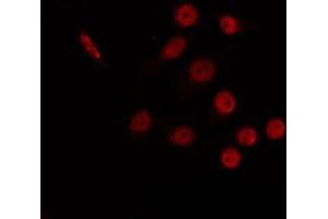 ABIN6266765 staining 293 by IF/ICC.