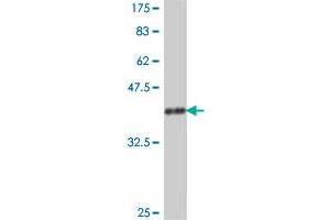 Western Blot detection against Immunogen (37 KDa) . (PARN anticorps  (AA 501-599))
