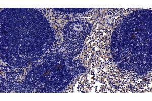 Detection of IL1R1 in Rat Lymph node Tissue using Polyclonal Antibody to Interleukin 1 Receptor Type I (IL1R1)