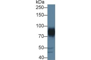 Western Blot; Sample: Porcine Cerebrum lysate; Primary Ab: 1µg/ml Rabbit Anti-Human ADAM22 Antibody Second Ab: 0. (ADAM22 anticorps  (AA 370-582))