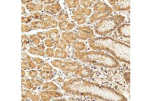 IHC analysis of Occludin/OCLN using anti-Occludin/OCLN antibody (ABIN7601995).