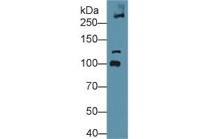 Western blot analysis of Mouse Bladder lysate, using Mouse COL6a3 Antibody (1 µg/ml) and HRP-conjugated Goat Anti-Rabbit antibody ( (COL6a3 anticorps  (AA 2009-2205))