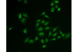 Immunofluorescence analysis of U2OS cells using SSRP1 antibody (ABIN6129537, ABIN6148493, ABIN6148495 and ABIN6222048).