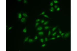 Immunofluorescence analysis of U2OS cells using SSRP1 antibody (ABIN6129537, ABIN6148493, ABIN6148495 and ABIN6222048). (SSRP1 anticorps  (AA 1-300))