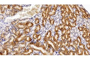 Detection of CAT in Mouse Kidney Tissue using Polyclonal Antibody to Catalase (CAT) (Catalase anticorps  (AA 401-523))